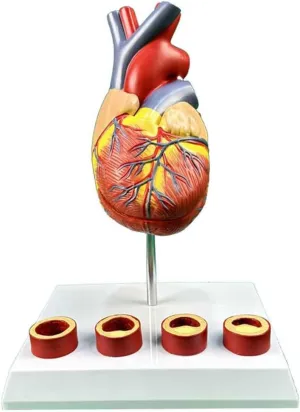 Teaching Model,3D Heart Model Life Size Heart Anatomical Model with 2 Detachable Parts & 4 Thbus Vessels for Teaching Models Doctor-Patient Communication